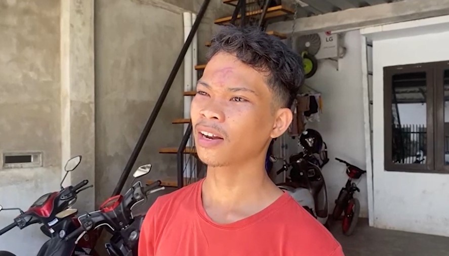 Kesal Tidak Diberi Rokok, Preman Keroyok Mahasiswa Makassar di Depan Kos